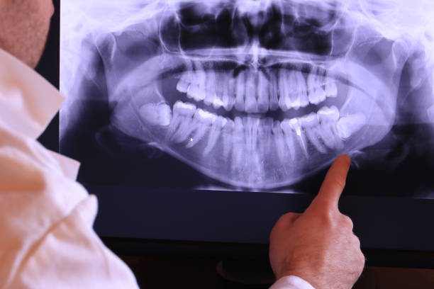 Trusted LA Emergency Dental Service Experts