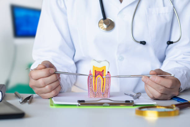 Best Knocked-Out Tooth (Avulsed Tooth) Treatment in Patterson, LA